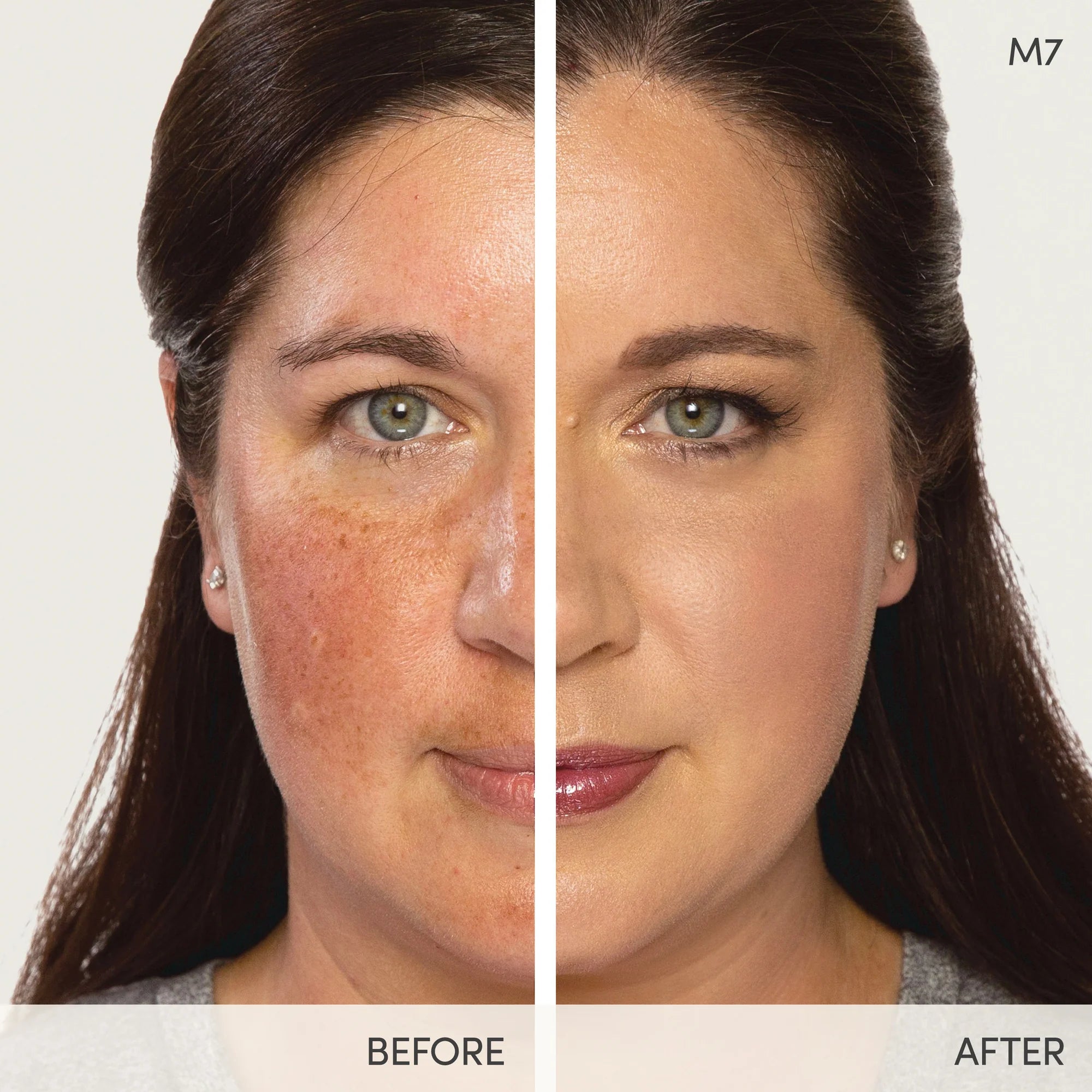 before and after applying Jane Iredale Beyond Matte™ Liquid Foundation. A clean, weightless, multitasking 3-in-1 foundation with buildable, stay-put coverage and a natural-looking semi-matte finish. Formulated with skin-nourishing, plant-based ingredients. Jane Iredale Australian stockist. Free Shipping for orders over $350. Shipping only in Australia. Shop now!