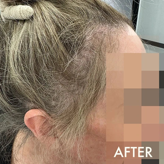 After using La Biosthetique Methode Regenerante range for hair loss and age-related thinning.