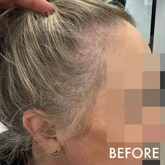Before using La Biosthetique Methode Regenerante range for hair loss and age-related thinning.