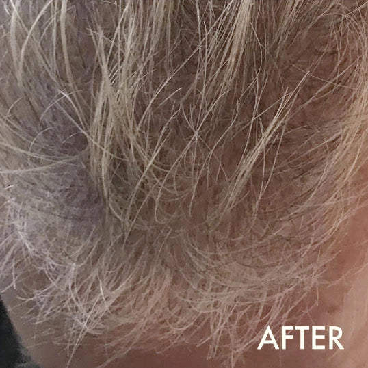 After using La Biosthetique Methode Regenerante range for hair loss and age-related thinning.