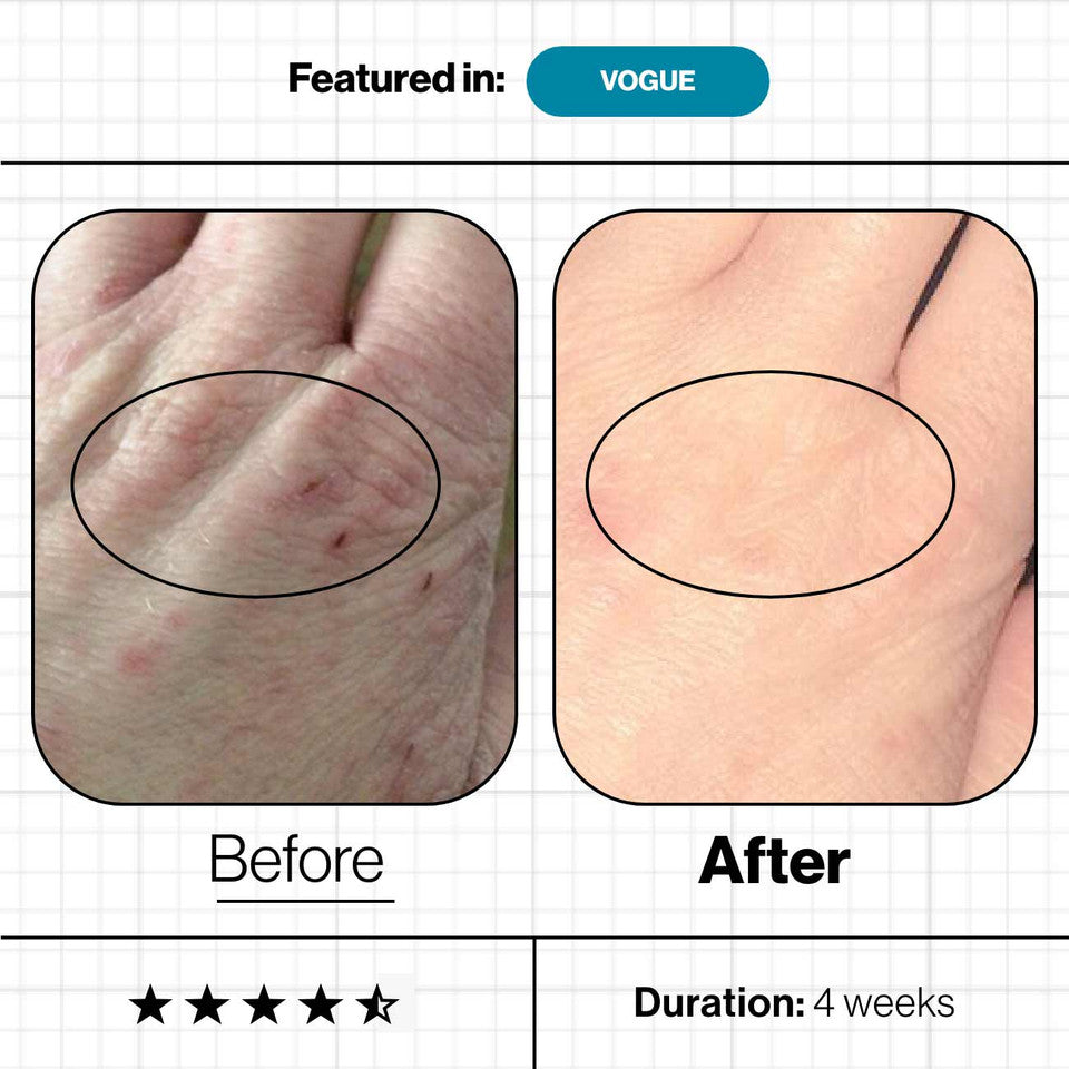 Advanced Nutrition Programme's Skin Skin Omegas+ before and after use