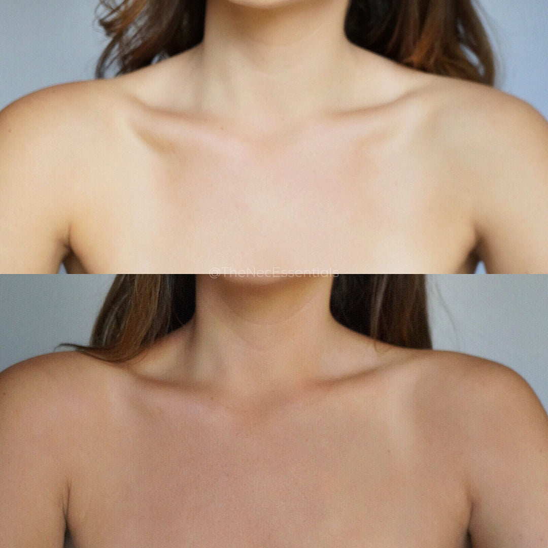 Ecotan's Cacao Tanning Mousse before and after. Eco Tan Australian stockist. Free Shipping for orders over $350. Shop now!