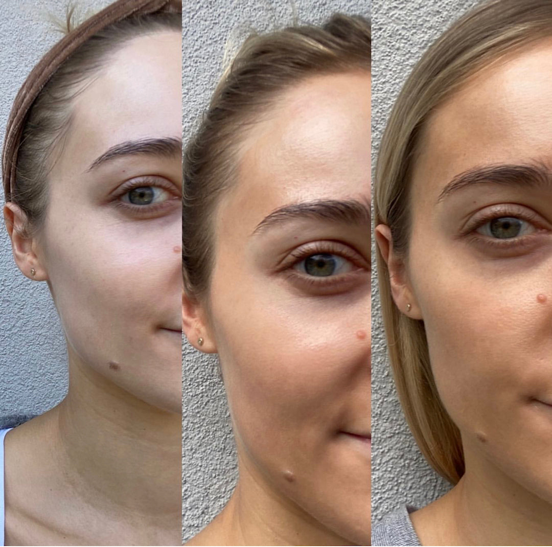 Eco Tan's Face Tan Water before and after use. Tanning Product. The best and original natural organic face tan water, that clears your skin while delivering a healthy golden glow. Take your skincare to the elite level. Eco Tan Australian stockist. Free Shipping for orders over $350. Shop now!