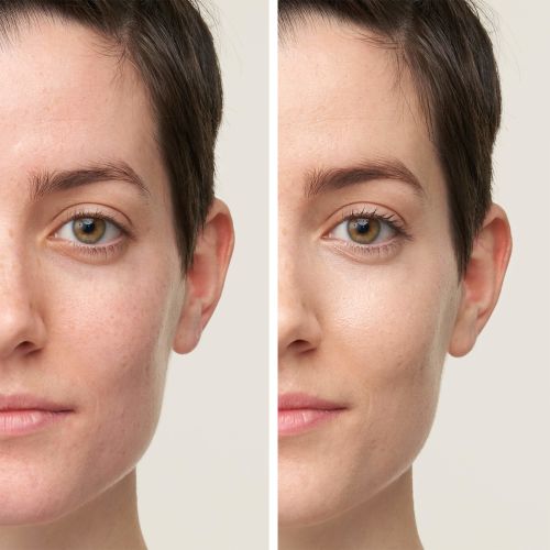 Jane Iredale under eye concealer before and after applying. Jane Iredale Australian stockist. Free Shipping for orders over $350. Shipping only in Australia. Shop now!