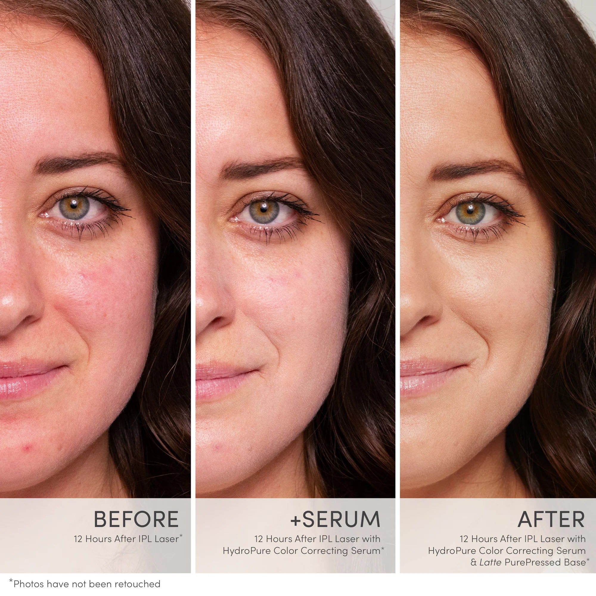 Jane Iredale's HydroPure™ Color Correcting Serum with Hyaluronic Acid & CoQ10  Before and After picture