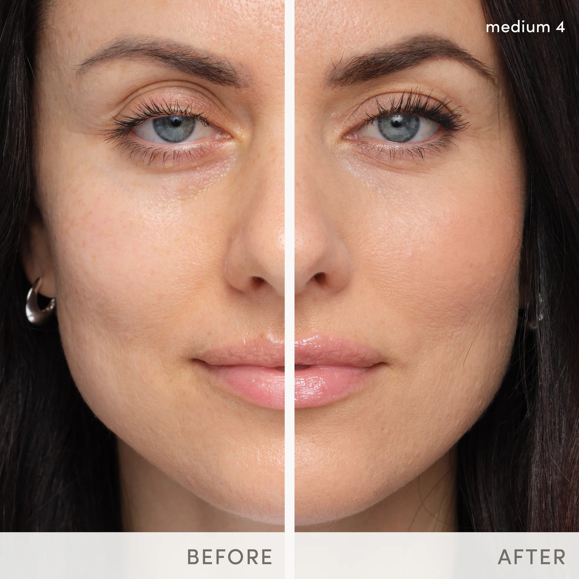 Jane Iredale's HydroPure™ Tinted Serum with Hyaluronic Acid & CoQ10 - shade Medium 4. Before and after photos. Jane Iredale Australian stockist. Free Shipping for orders over $350. Shipping only in Australia. Shop now!