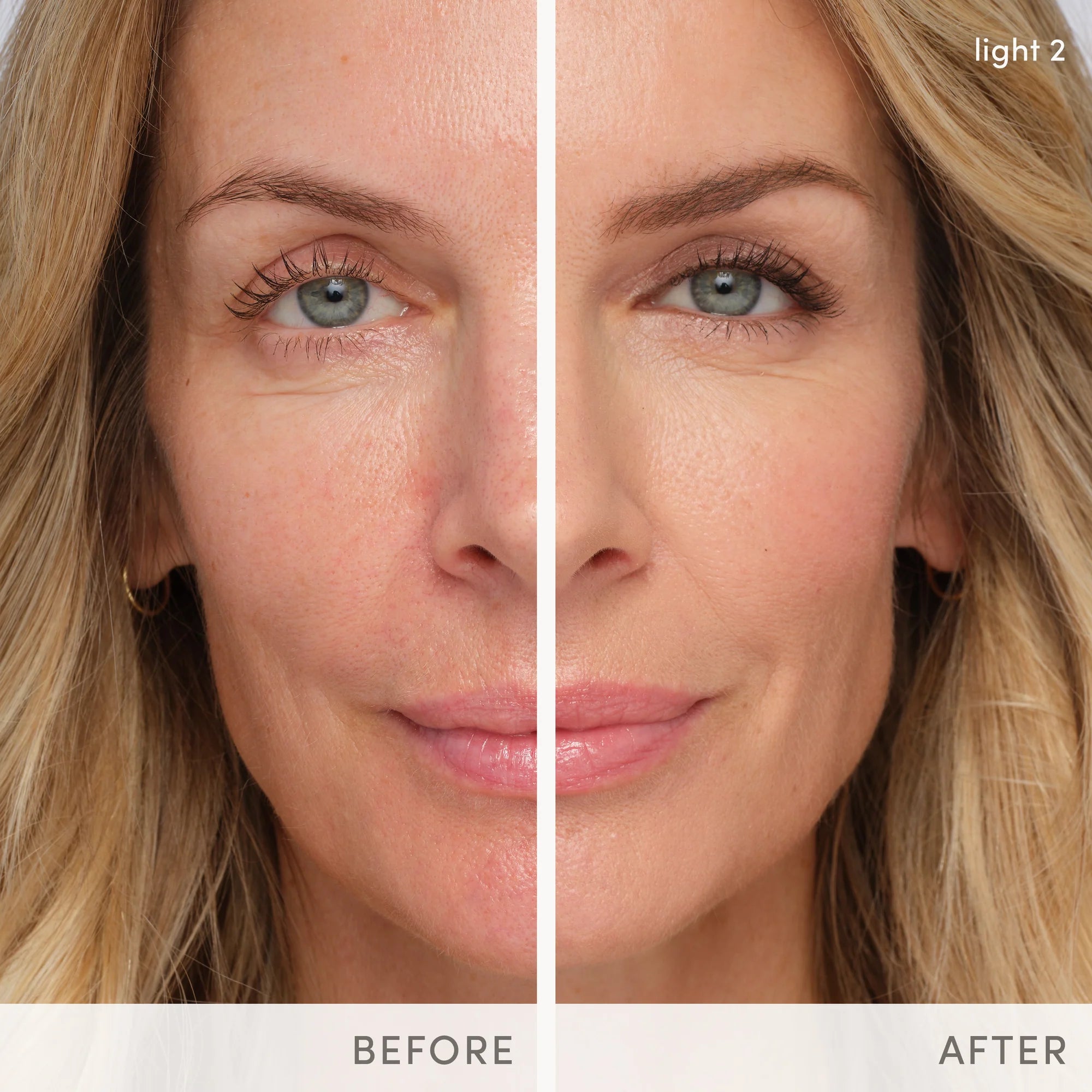 Jane Iredale's HydroPure™ Tinted Serum with Hyaluronic Acid & CoQ10 - shade Light 2. Before and after photos. Jane Iredale Australian stockist. Free Shipping for orders over $350. Shipping only in Australia. Shop now!