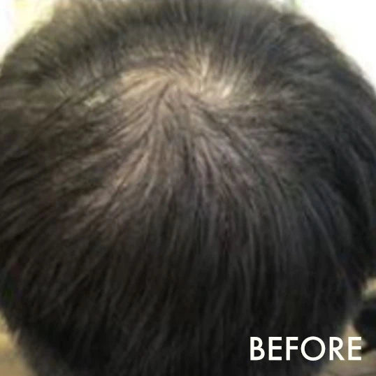 Before using La Biosthetique Methode Regenerante range for hair loss and age-related thinning.