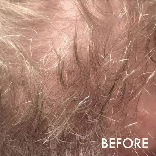 Before using La Biosthetique Methode Regenerante range for hair loss and age-related thinning.