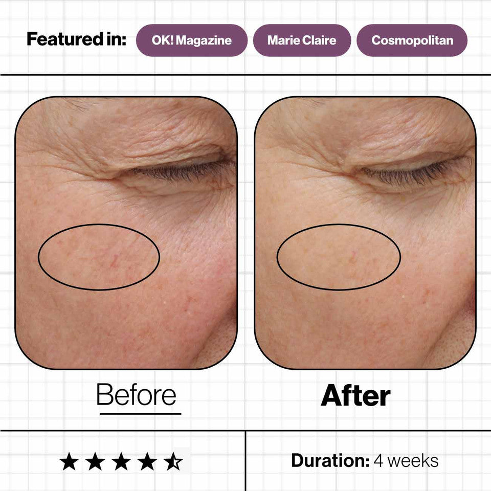 Advanced Nutrition Programme's Skin Complete 140 capsules - before and after