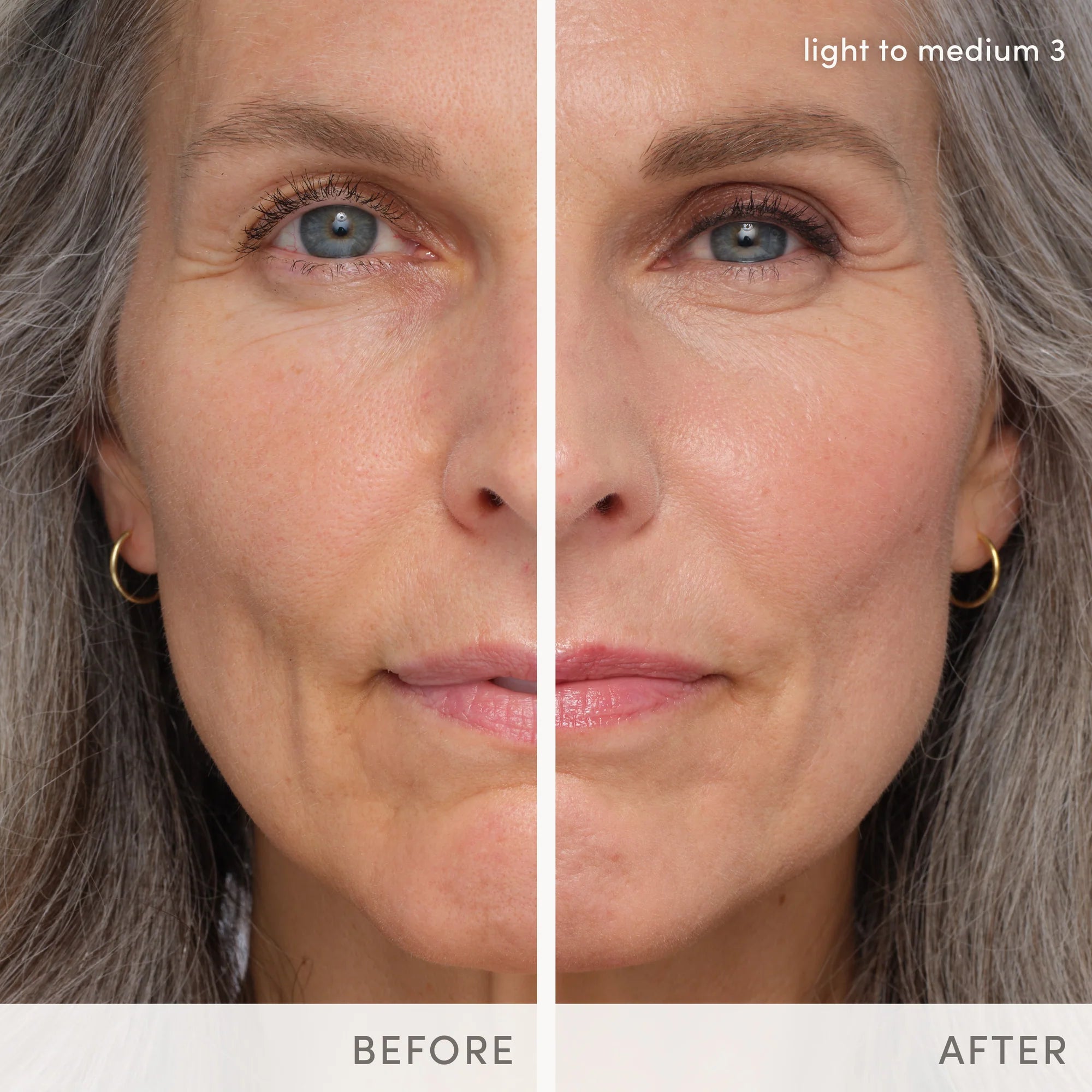 Jane Iredale's HydroPure™ Tinted Serum with Hyaluronic Acid & CoQ10 - shade Light to Medium 3. Before and after photos. Jane Iredale Australian stockist. Free Shipping for orders over $350. Shipping only in Australia. Shop now!
